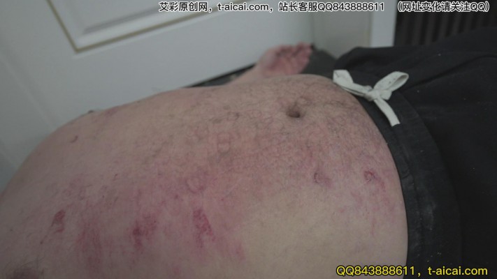 兔子牙 超模之下体无完肤 旧伤新伤持续腐烂 YC-230303-2 -套路艾彩视频